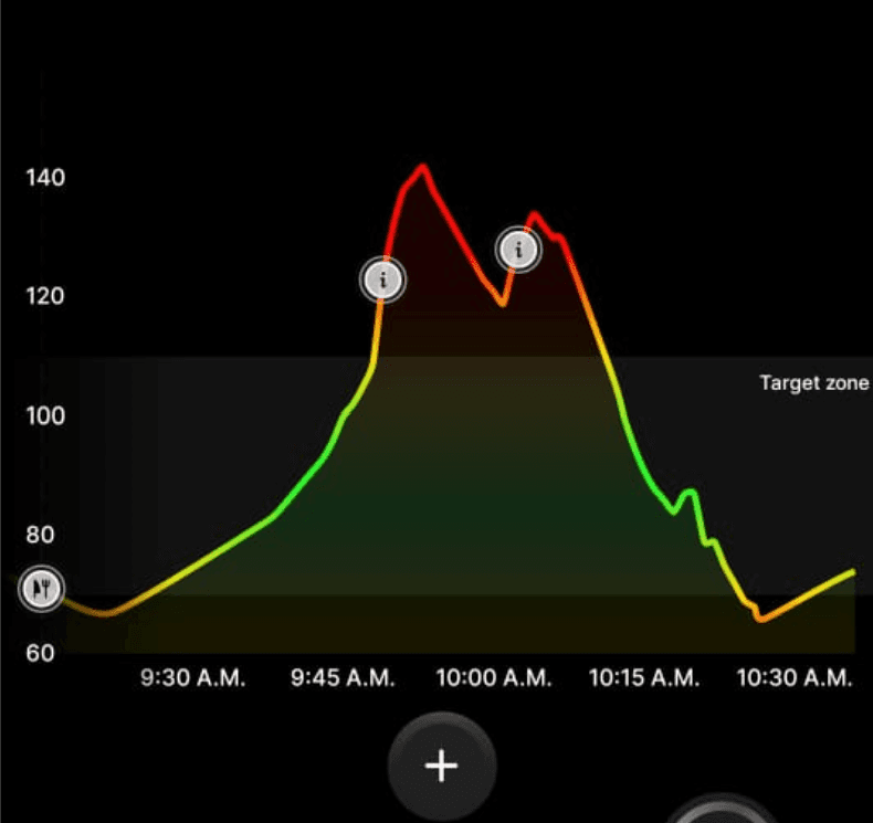 Glucose crash CGM graph